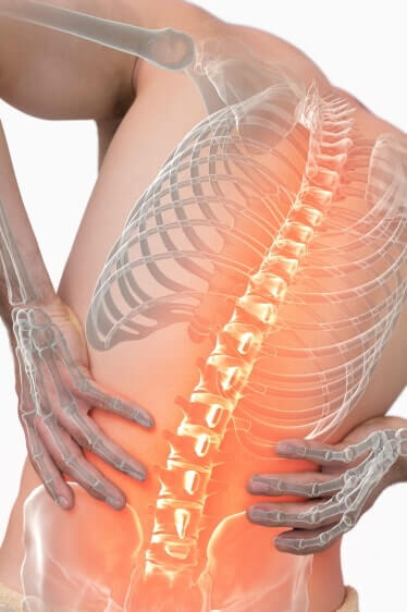 CBD lindert bei Rückenschmerzen