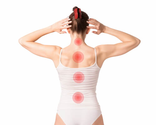Nerv eingeklemmt im Rücken - Rückenschmerzen
